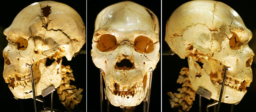 características del cráneo del homo heidelbergensis