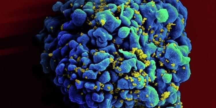Las personas que padecen de VIH tienen un tratamiento que consiste en la combinación de varios fármacos