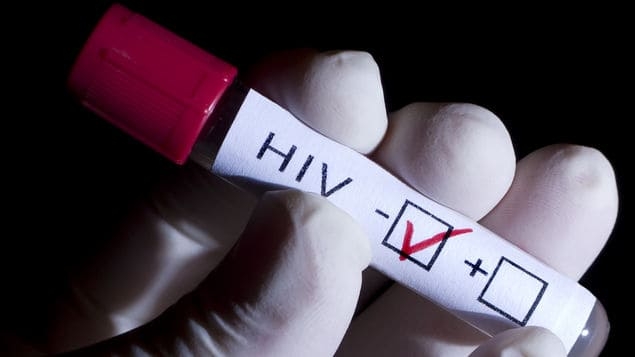 Las cifras del VIH en Europa superan ahora los 2 millones, según la OMS