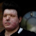 La víctima de ataque ácido Andreas Christopheros, posa para una fotografía en su casa en Truro, al suroeste de Inglaterra, Gran Bretaña