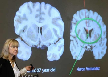 El cerebro de Aaron Hernández revela un secreto oscuro del fútbol americano