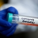 La ivermectina es aplicada in vitro para frenar el coronavirus COVID-19 / Foto  REUTERS/Thomas Peter