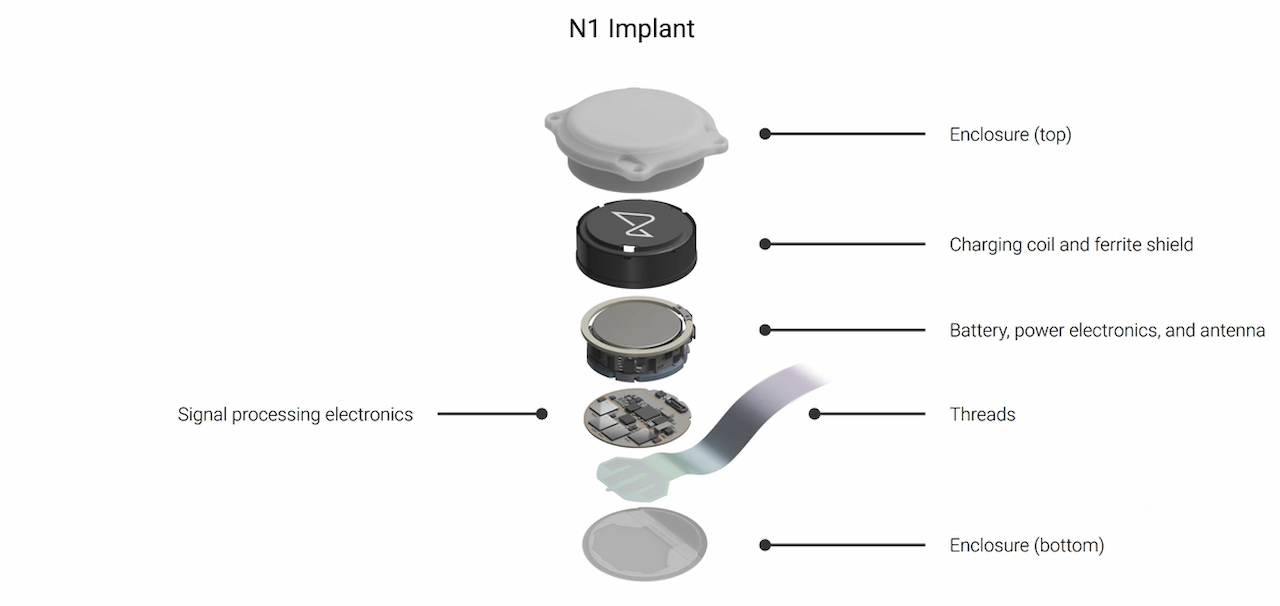 fallo de Neuralink