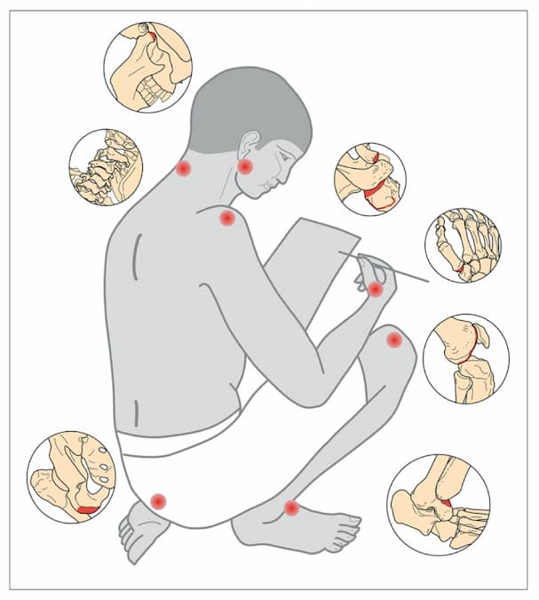 La ergonomia