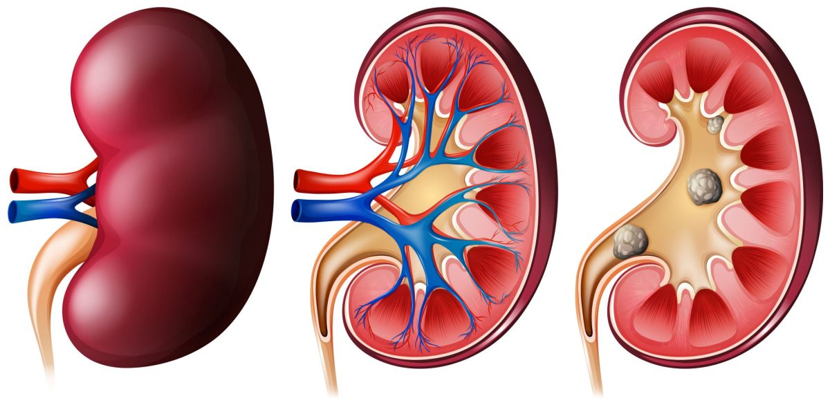 salud renal